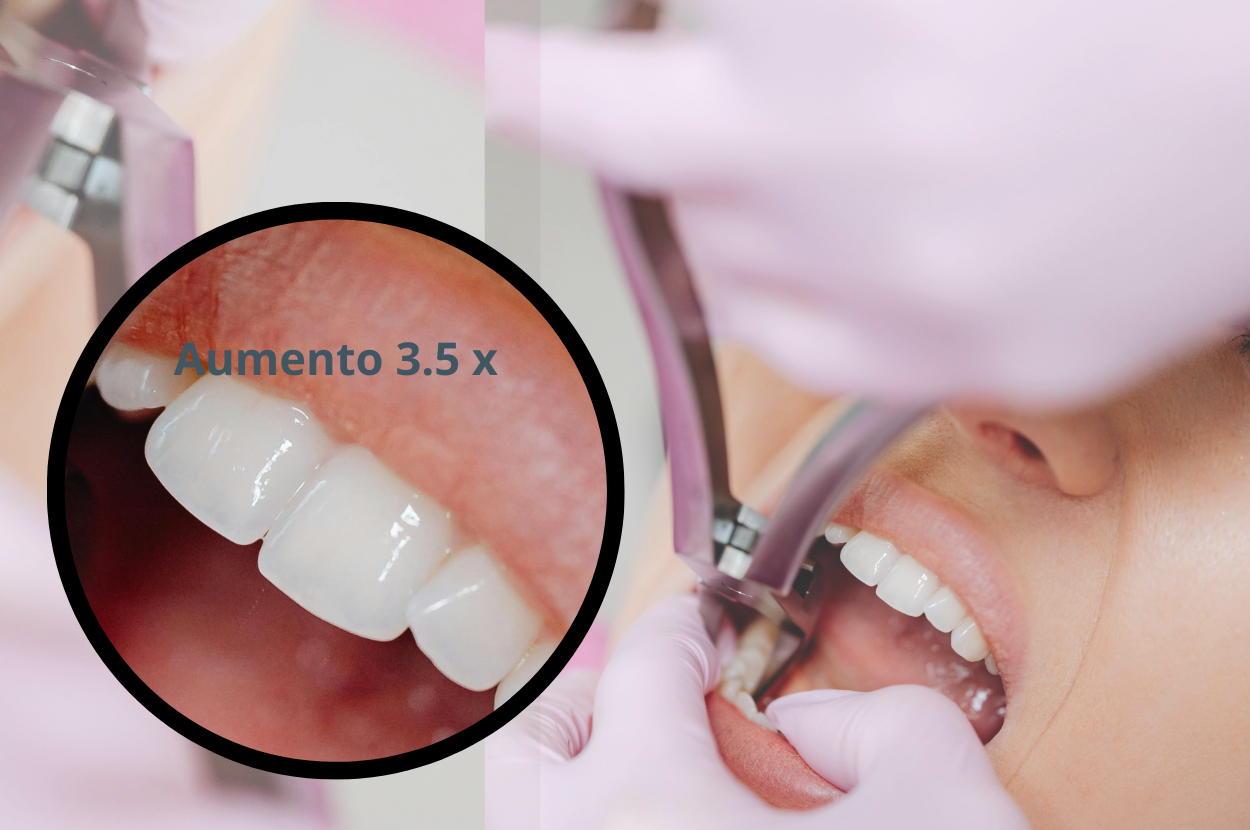 Lupas Dental Sport Flip-up  Negra